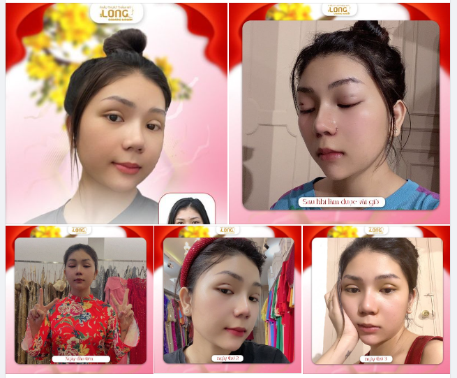 TẾT VỀ, MAU MAU LÀM ĐẸP ĐÓN MÙA TẾT CẬN KỀ