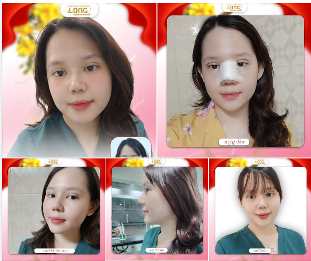 BẠN ĐÃ TỪNG TRẢI NGHIỆM CẢM GIÁC PHẪU THUẬT THẨM MỸ LÀ NHƯ THẾ NÀO?