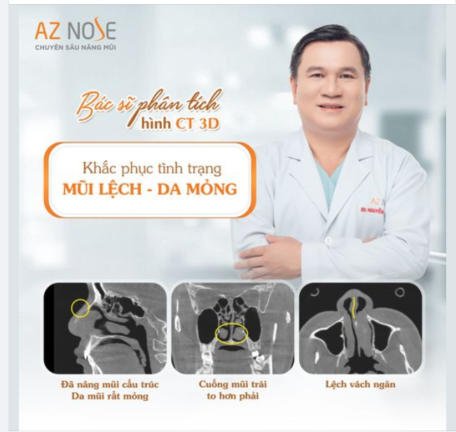 Rất khó để hiểu hết cấu trúc mũi của mình, cho đến khi... chụp CT3D.