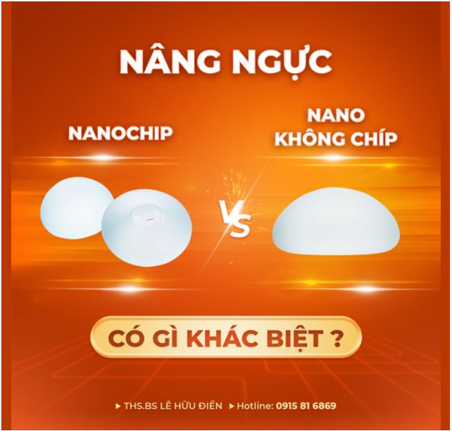 Nâng ngực nano chip và không chip có gì khác biệt