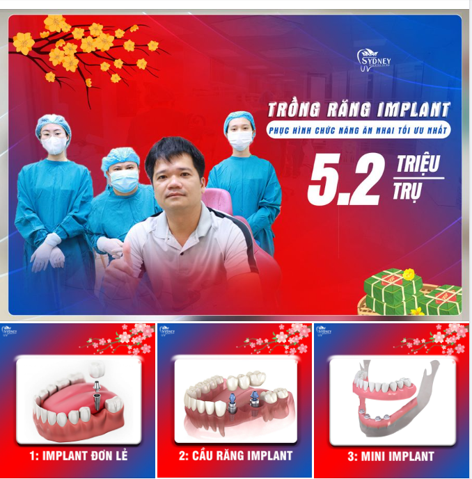 ƯU ĐÃI TRỒNG RĂNG IMPLANT – RĂNG KHỎE ĐÓN TẾT VUI