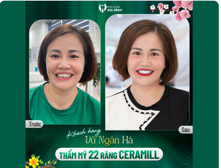 Chào đón một năm mới với diện mạo mới đẹp hơn, chắc chắn bạn sẽ tự tin và khởi đầu một năm mới vô cùng thành công, hạnh phúc hơn đấy nhé!