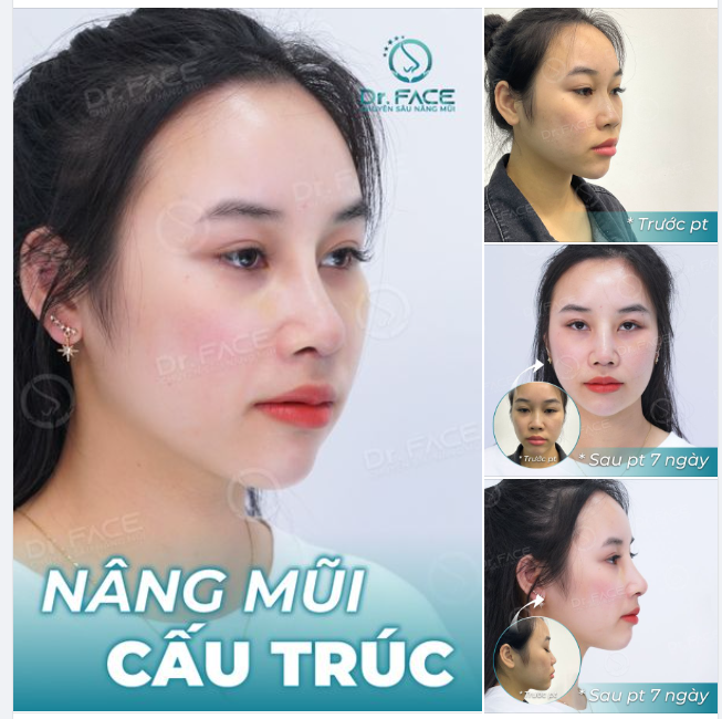 Điều tốt đẹp nhất là điều đến muộn nhất. Bạn đã bao giờ nghe câu nói này chưa? Cũng hợp lý ha, tuy nhiên còn phải xem lúc nào là muộn nhất thì mới chính xác được.