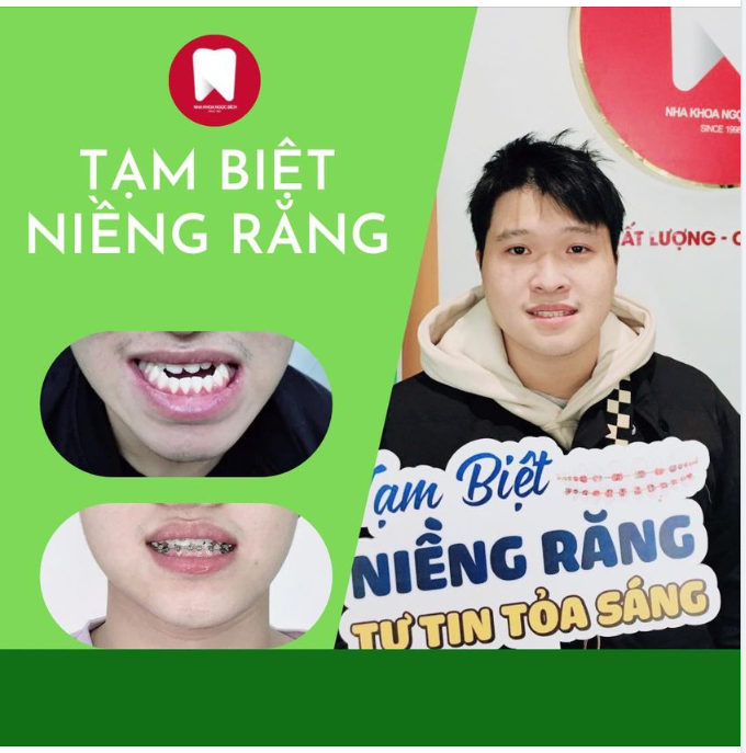 THÁO NIỀNG ĐÓN TẾT - TẬN HƯỞNG NỤ CƯỜI XINH