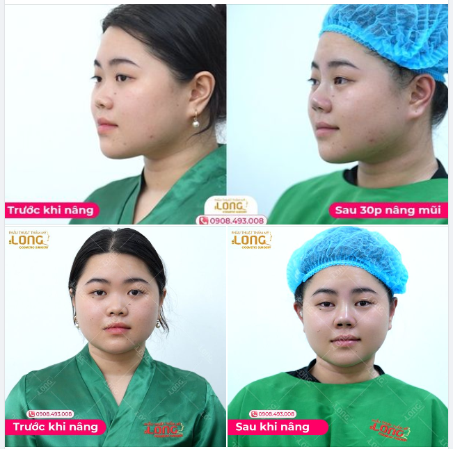 ĐỂ TẾT NÀY “YÊU KIỀU” VÀ THẬT “MỸ MIỀU”