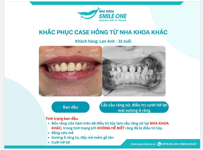 HÃY CẢNH GIÁC