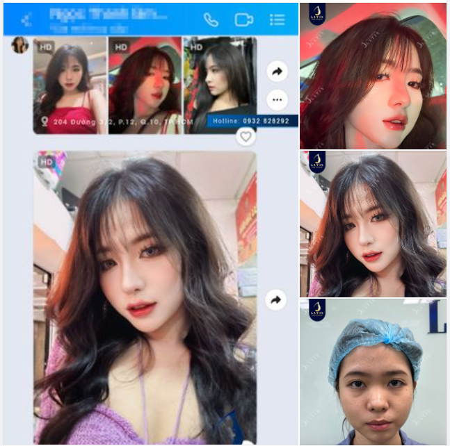 "Mũi em đẹp lắm chị ơi, ai gặp cũng khen"