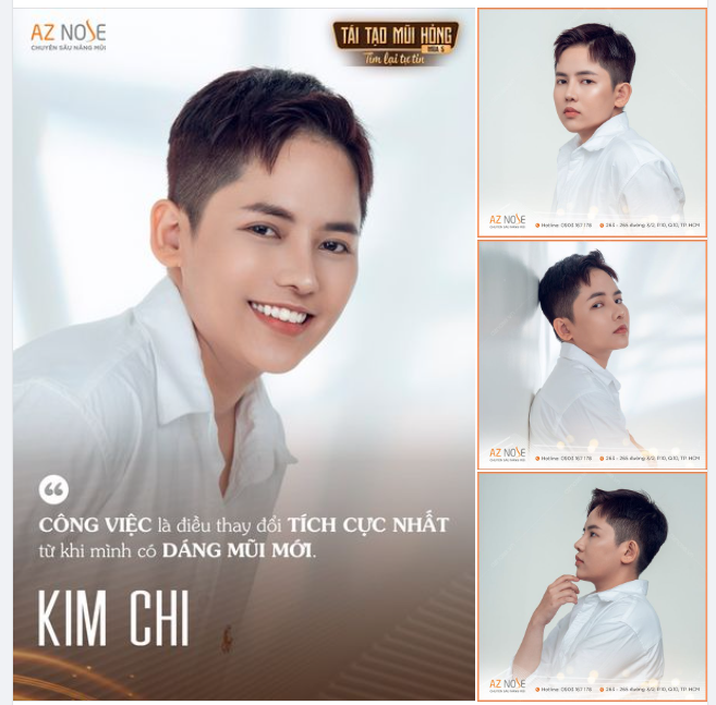 Thay đổi tích cực sau 4 tháng khắc phục mũi ngắn hếch