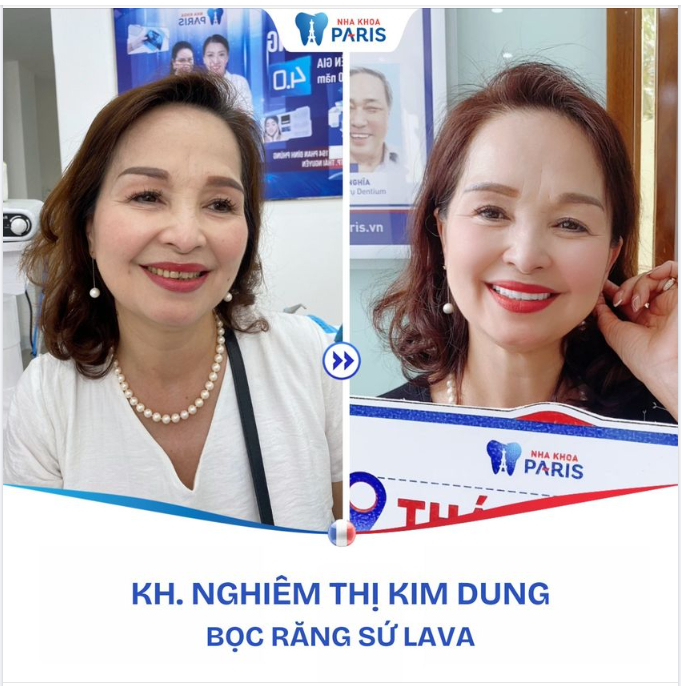 RĂNG THAY ÁO MỚI, ĐÓN TẾT RẠNG NGỜI