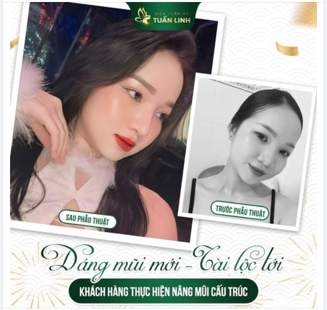 NĂM MỚI - DÁNG MŨI MỚI - ĐÓN TÀI LỘC TỚI!!