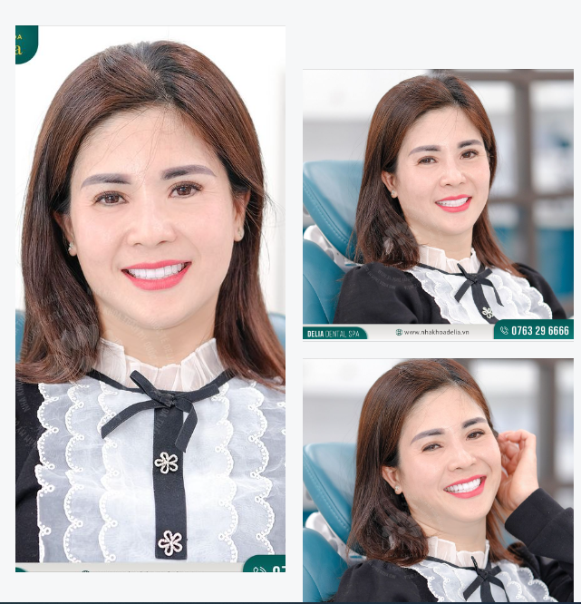 Đi cùng nụ cười rạng rỡ và sự hài lòng của chị Ninh Hương là niềm hạnh phúc của nha khoa Delia.