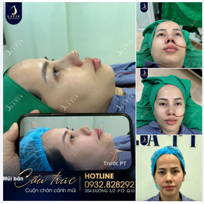 45 tuổi bắt đâu làm đẹp có muộn không. Dù có bao nhiêu tuổi thì làm đẹp chưa bao giờ là muộn.