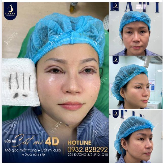 COMBO xinh đẹp trẻ trung cho chị em, bất chấp thời gian