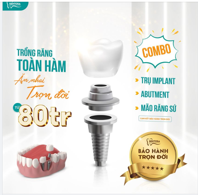 TRỒNG RĂNG TOÀN HÀM GIÁ COMBO TỪ 80 TRIỆU