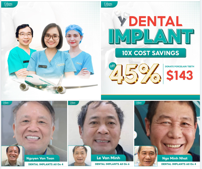 1000+ KHÁCH THĂM KHÁM QUỐC TẾ ĐƯỢC TRỒNG RĂNG CHẤT LƯỢNG TẠI SINGAPORE TẠI PHÒNG KHÁM NHA KHOA SENTOSA