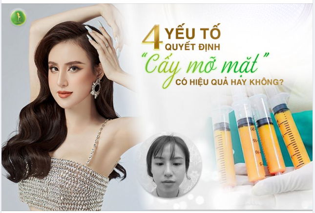 CẤY MỠ MẶT HIỆU QUẢ HAY KHÔNG DỰA TRÊN NHỮNG YẾU TỐ NÀO?