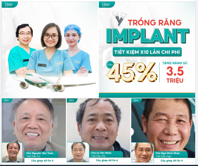 1000+ KHÁCH VIỆT KIỀU TRỒNG RĂNG CHẤT LƯỢNG SINGAPORE TẠI NHA KHOA SENTOSA
