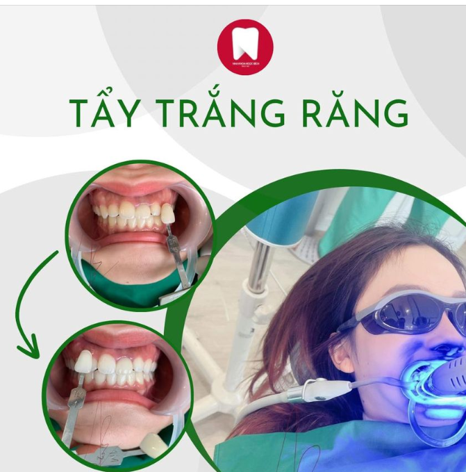 RĂNG TRẮNG SÁNG, SẴN SÀNG ĐÓN TẾT