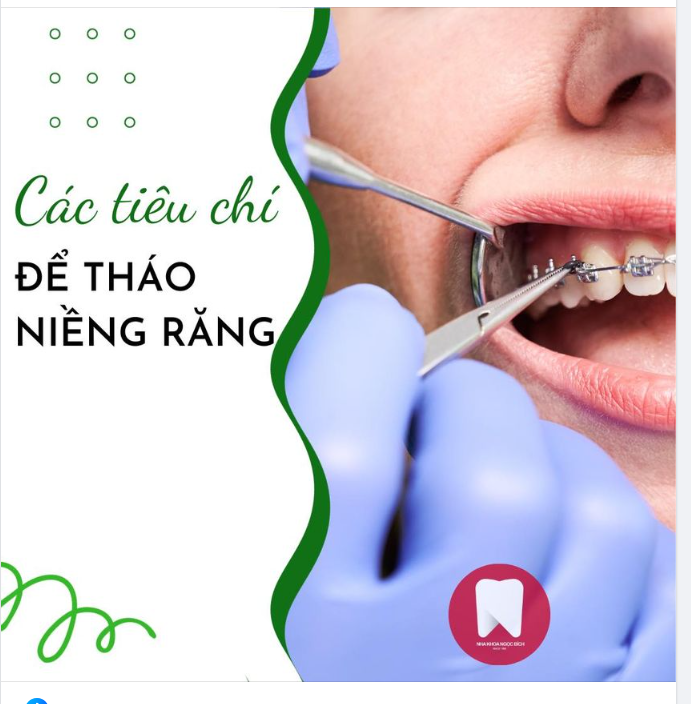 CÁC TIÊU CHÍ ĐỂ THÁO NIỀNG RĂNG