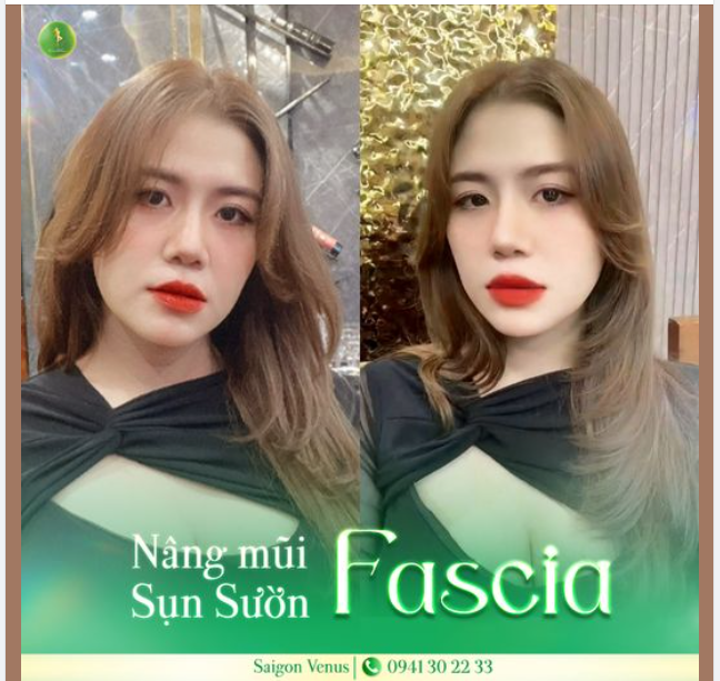 FEEDBACK DÁNG MŨI CHUẨN 100% CỦA SAIGON VENUS