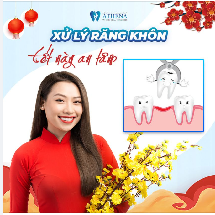 DẸP BỎ RĂNG KHÔN - TẾT NÀY THÊM AN TÂM!!!!