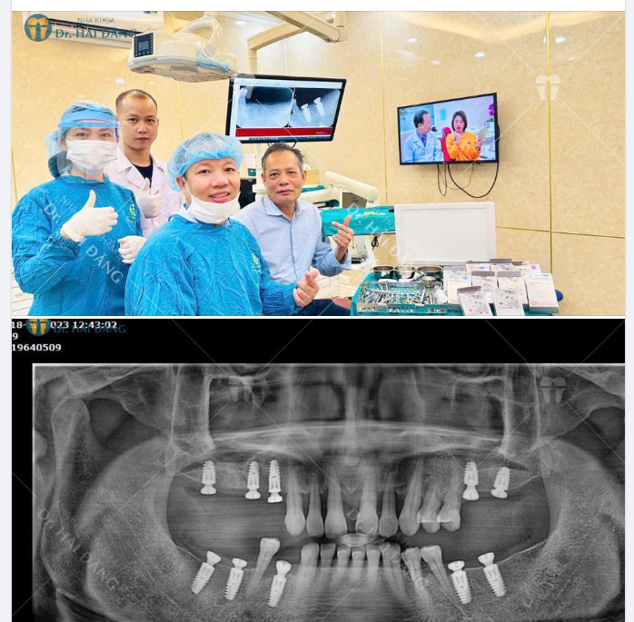 VÌ SAO KIỀU BÀO LẠI CHỌN TRỒNG RĂNG TẠI NHA KHOA HẢI ĐĂNG