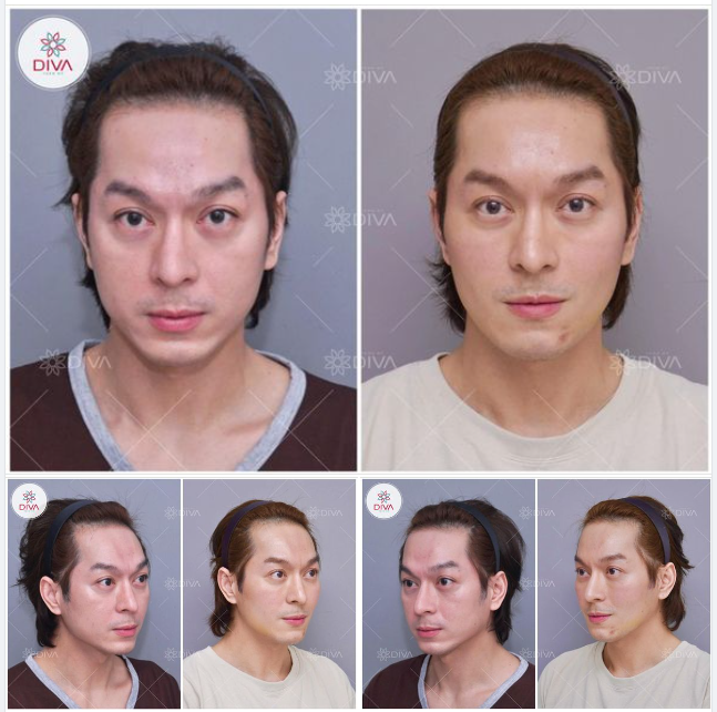 GƯƠNG MẶT SẼ THU HÚT HƠN KHI TỪNG CHI TIẾT HÀI HÒA