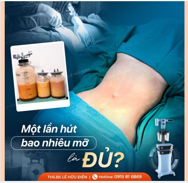 MỘT LẦN HÚT BAO NHIÊU MỠ LÀ ĐỦ