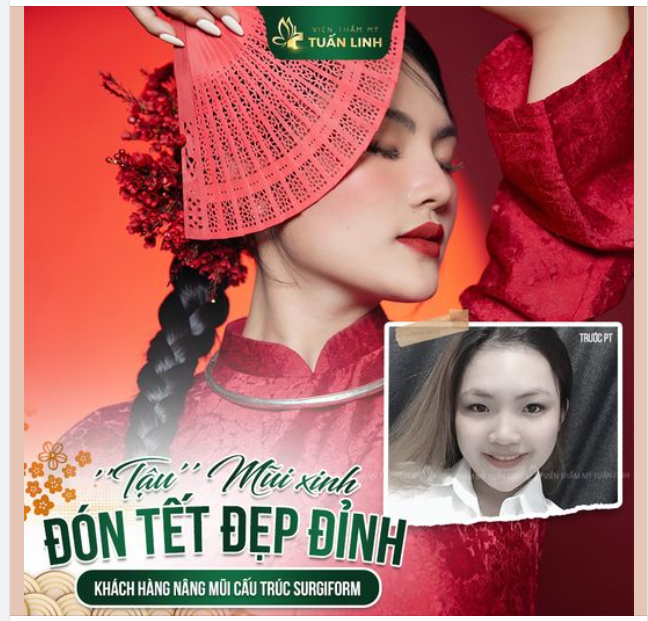 NÂNG MŨI XINH - ĐÓN TẾT ĐẸP ĐỈNH