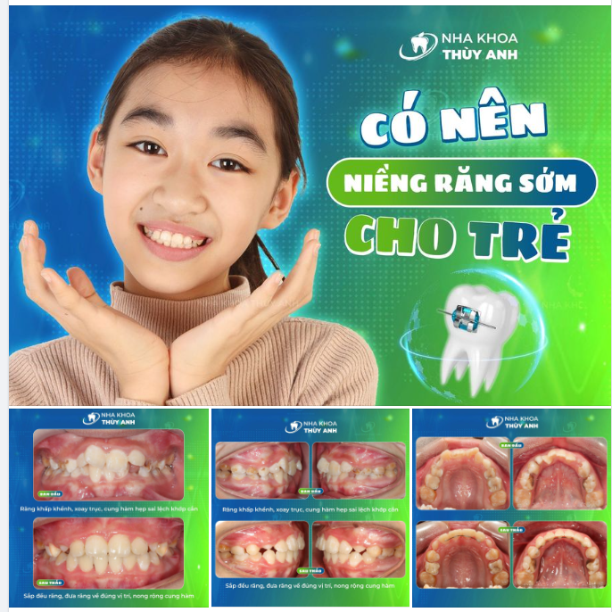 NỤ CƯỜI KHỎE ĐẸP TẶNG CON - PHONG BAO LÌ XÌ THIẾT THỰC HƠN BAO GIỜ HẾT