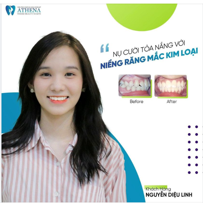 Niềng răng: Những trường hợp nhất định không nên niềng răng
