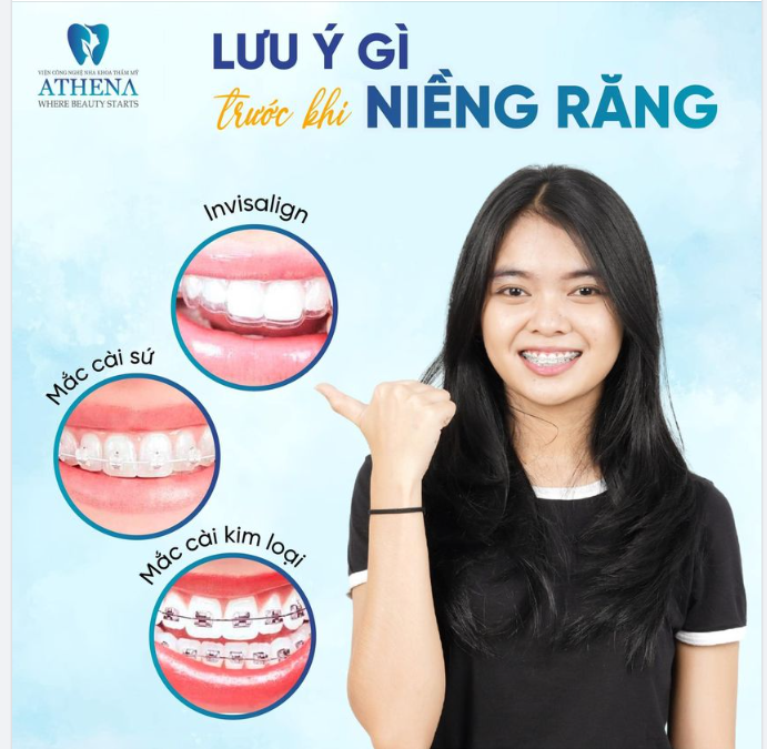 6 LƯU Ý QUAN TRỌNG NÊN ĐỌC NGAY TRƯỚC KHI NIỀNG RĂNG