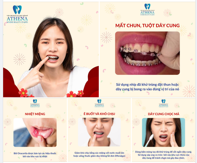 CÁC SỰ CỐ THƯỜNG GẶP KHI NIỀNG RĂNG VÀ CÁCH KHẮC PHỤC ĐƠN GIẢN TẠI NHÀ DỊP TẾT NÀY
