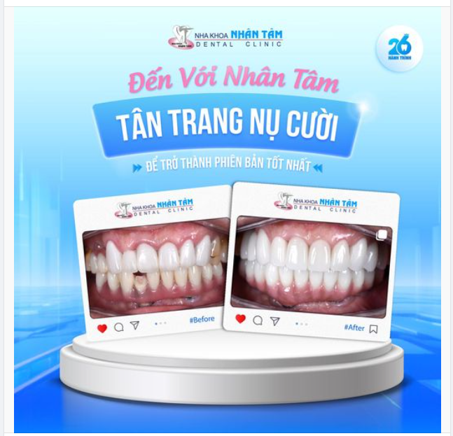 “Tôi quyết định làm lại răng vì tôi cảm thấy tự tin hơn khi có một nụ cười đẹp”