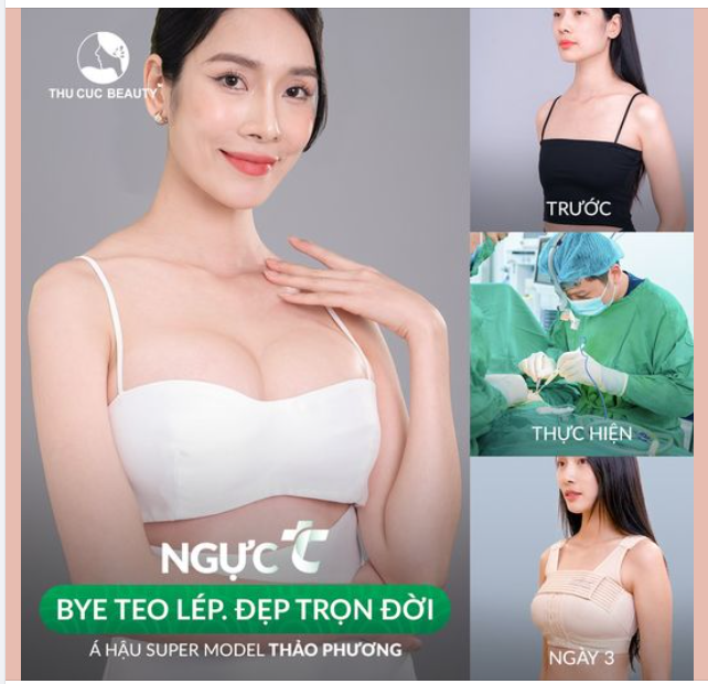 Nâng ngực Không đau. Hồi phục nhanh x2 Chọn Ngực TC