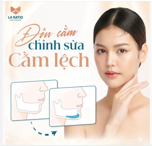 BẠN ĐÃ BIẾT MẶT BỊ LỆCH DO CẰM LỆCH CHƯA?