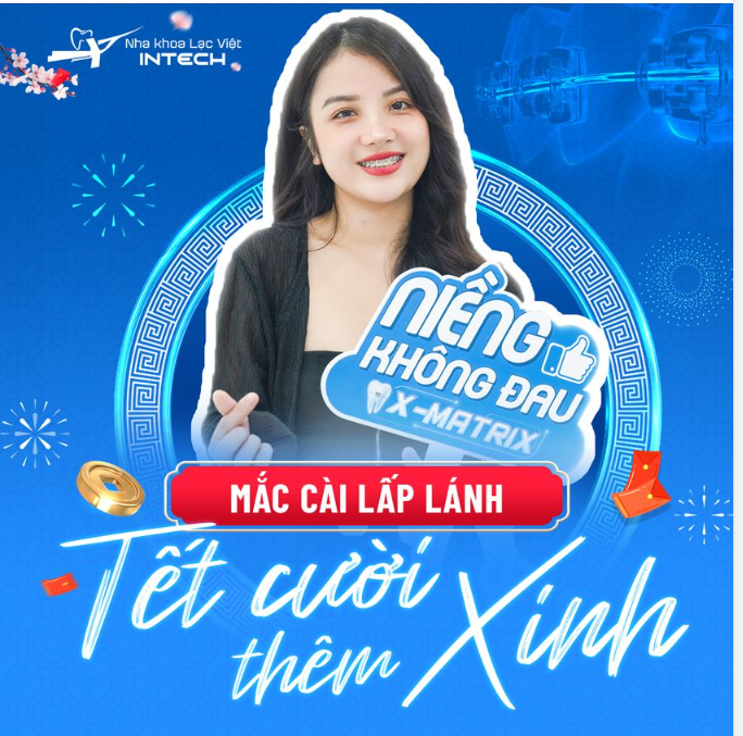MẮC CÀI LẤP LÁNH - TẾT CƯỜI THÊM XINH!