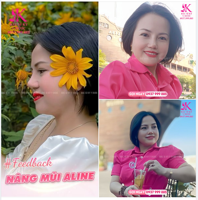 CHUYÊN MỤC FEEDBACK MŨI XINH