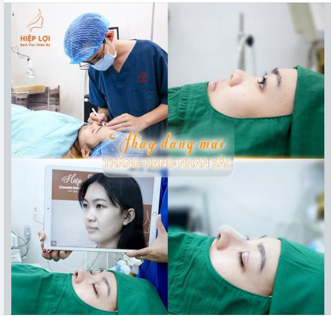 THAY DÁNG MŨI - THĂNG HẠNG NHAN SẮC