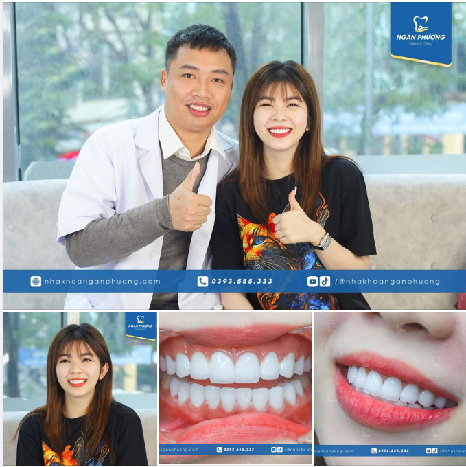 Răng đẹp đón xuân cho cô gái Hàn Ni