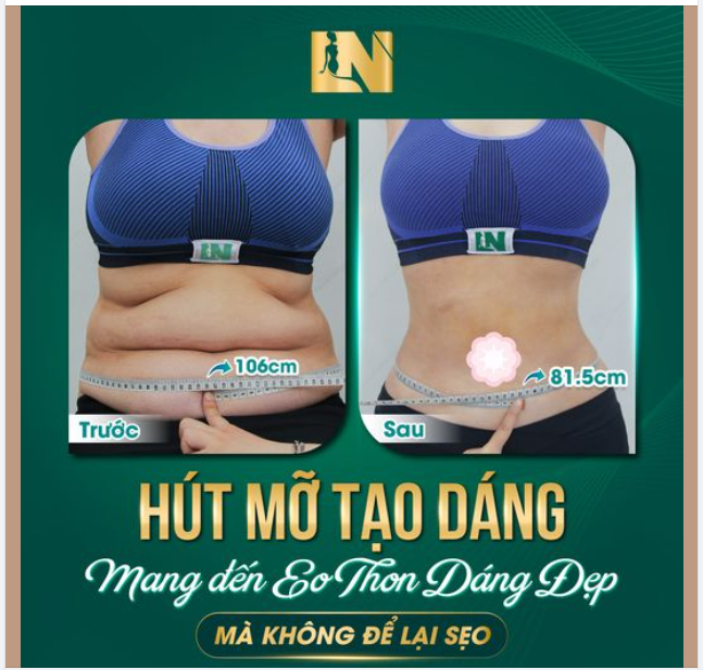 HÚT MỠ TẠO DÁNG MANG ĐẾN EO THON DÁNG ĐẸP MÀ KHÔNG ĐỂ LẠI SẸO