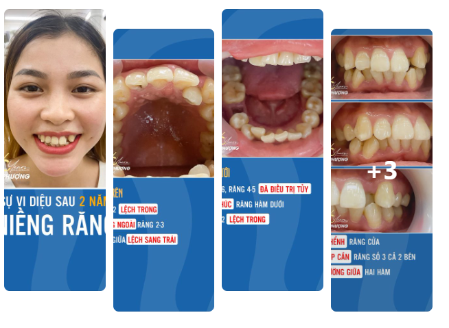 Giờ còn ai khoe doanh thu bao nhiêu, kiếm được bao nhiêu tiền nữa.