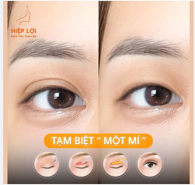 Tạm biệt MỘT MÍ - MÍ SỤP - Chỉ sau 45 phút