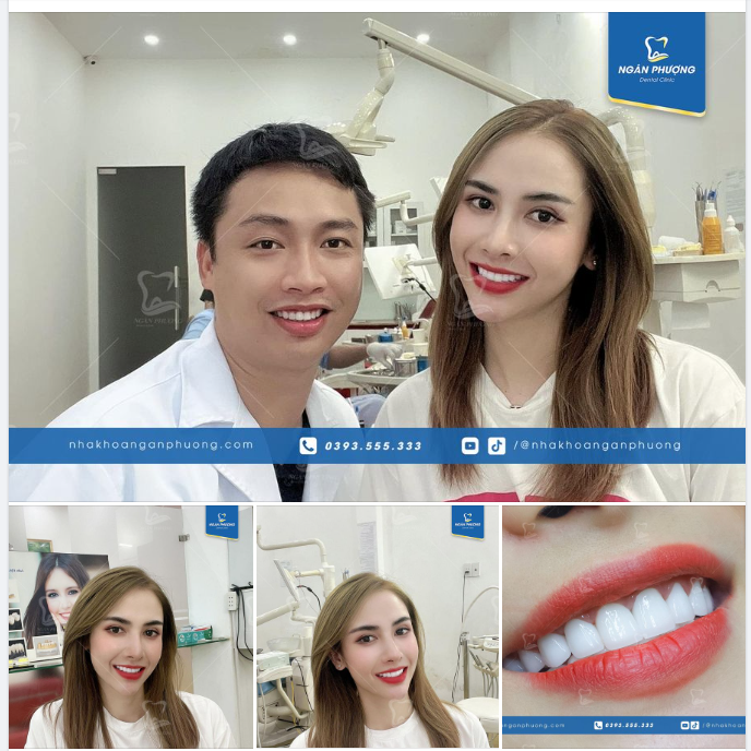 Người đẹp Đà Nẵng làm răng sứ lại càng đẹp hơn