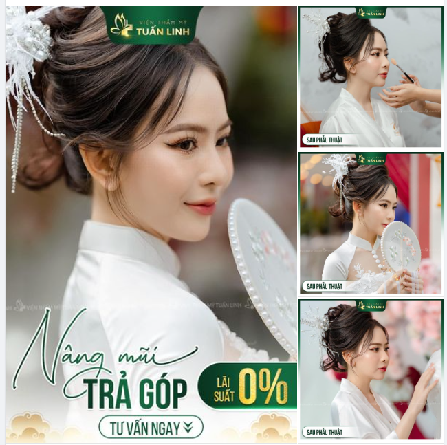 ĐẸP không cần ĐỢI  Với gói NÂNG MŨI TRẢ GÓP 0% LÃI SUẤT tại Tuấn Linh sẽ giúp bạn sở hữu cho mình nhan sắc xinh đẹp, quyến rũ nhất.