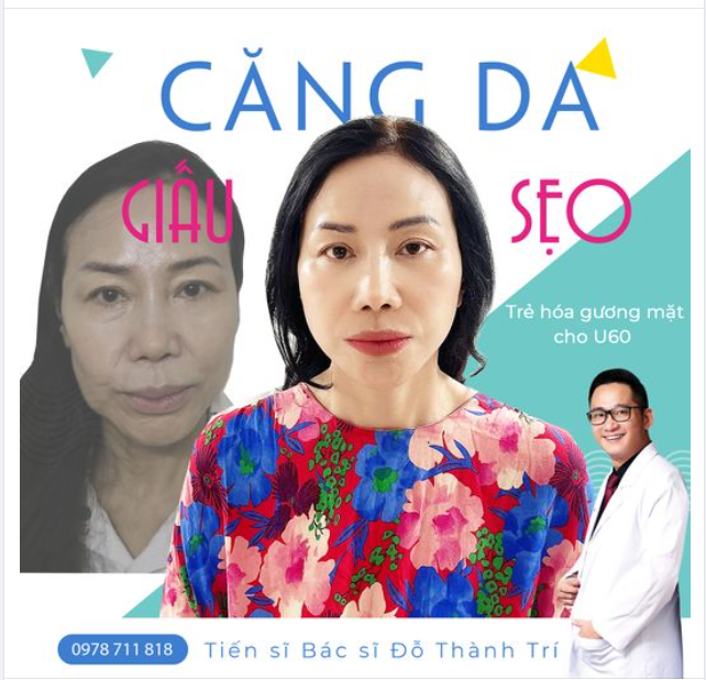 Chào Xuân 2024 - CĂNG DA GIẤU SẸO