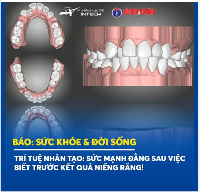 HƠN 90% BIẾN CHỨNG NIỀNG RĂNG XẢY RA DO SAI SÓT TỪ KẾ HOẠCH ĐIỀU TRỊ!