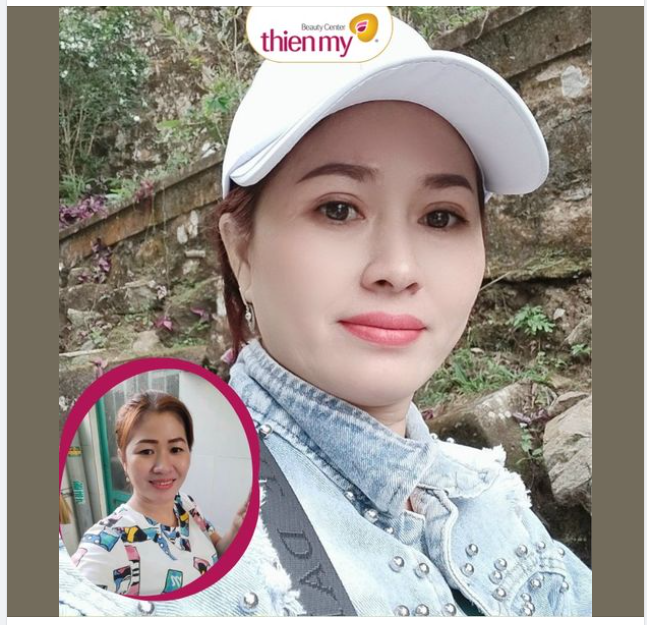 Feedback cắt mí uy tín luôn ạ