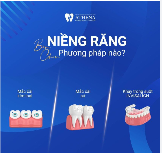 BẠN CHỌN GÌ CHO HÀNH TRÌNH NIỀNG RĂNG CỦA MÌNH