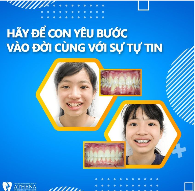 HÃY ĐỂ CON YÊU BƯỚC VÀO ĐỜI CÙNG VỚI SỰ TỰ TIN